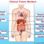 Tumor markeri